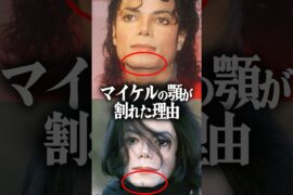 マイケルジャクソンの顎が割れていった理由